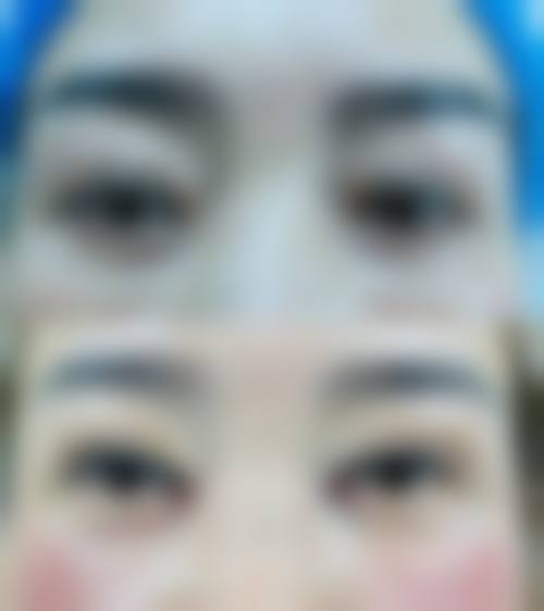 重庆优思悦美医疗美容诊所价格收费