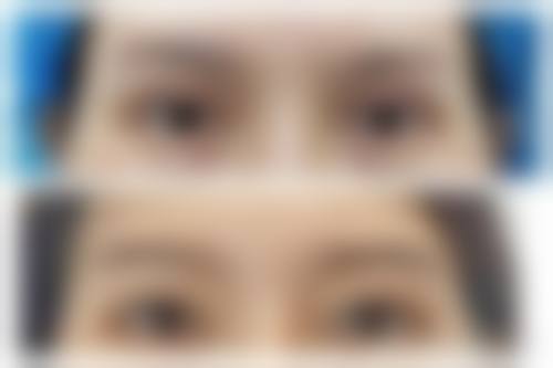 重庆优思悦美医疗美容诊所求美者反馈