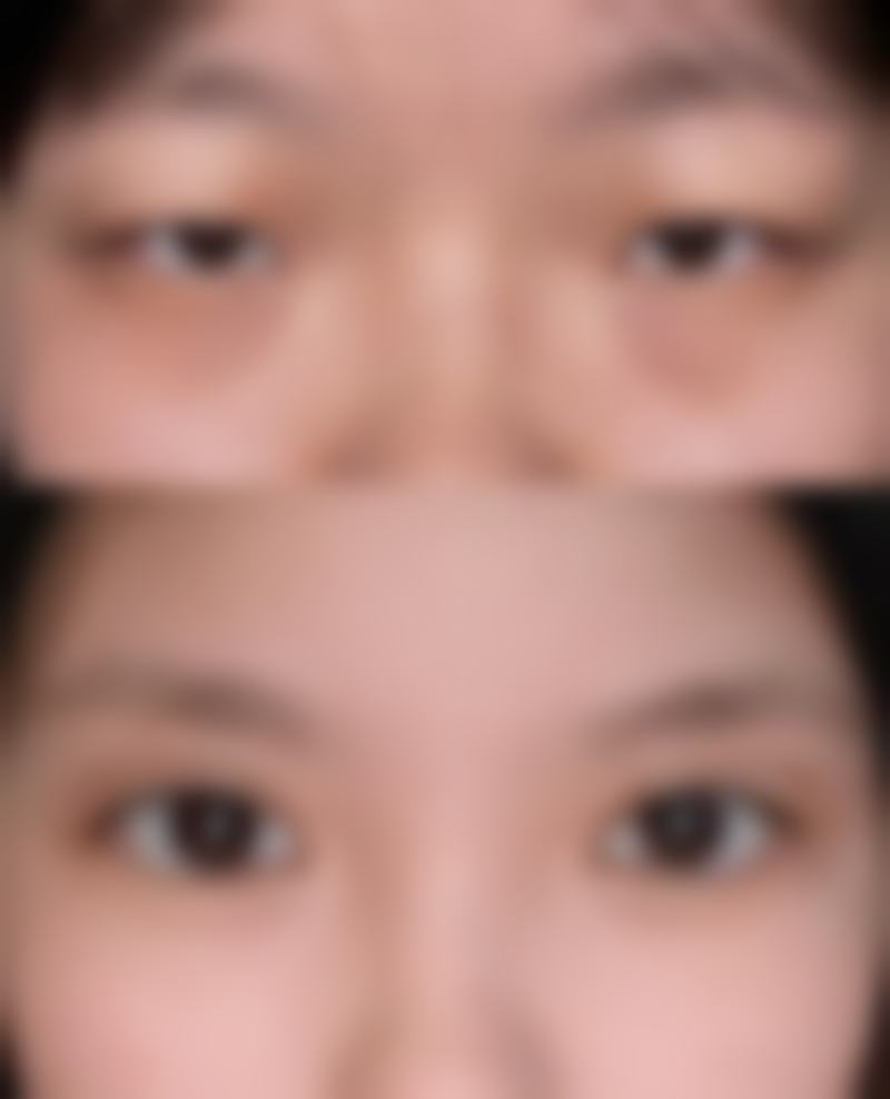 贵阳美贝尔整形医院求美者反馈