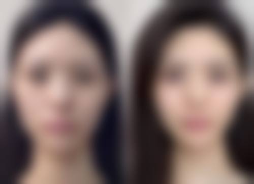 太原金尚整形医院来院路线