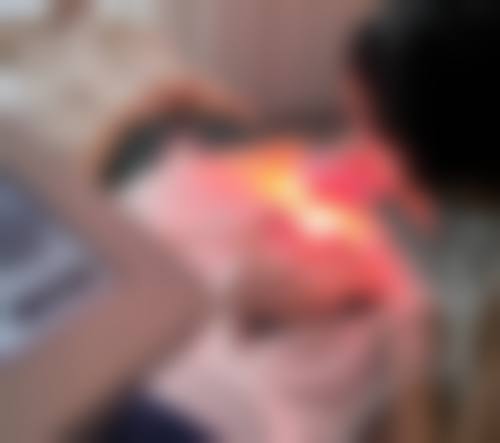 江阴悦辰整形医院价格收费