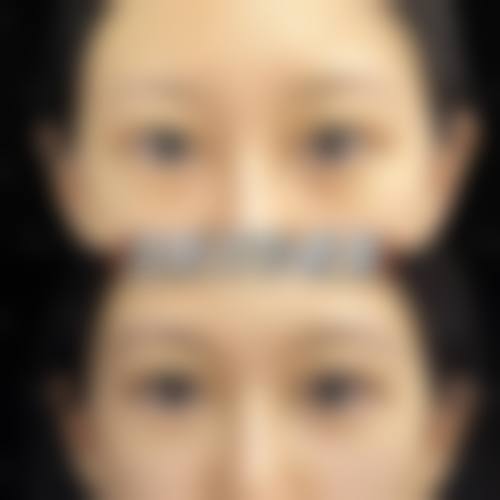 台州温岭美辰医疗美容医院求美者反馈