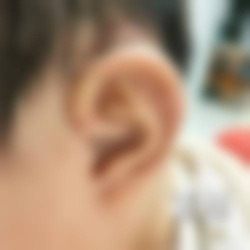 兰州市妇幼保健院求美者反馈