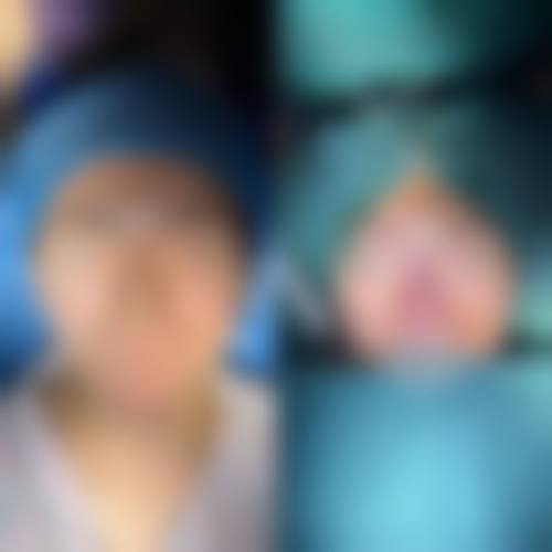 蚌埠市国色整形美容医院求美者反馈