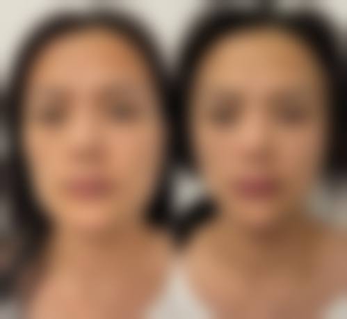 成都美卿医疗美容医院价格收费