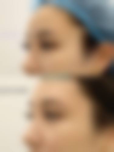 郑州可莱喜整形美容医院求美者反馈
