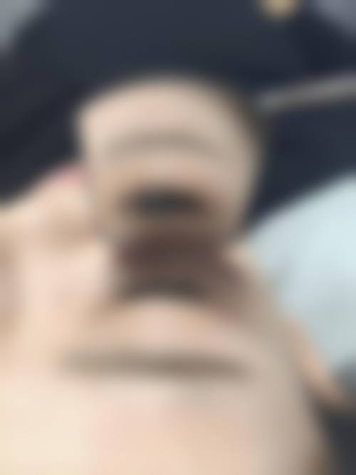 东莞科生植发医疗美容门诊部价格收费