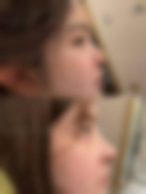 透明化的医美收费保护