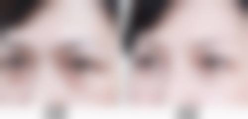 东莞唯美医学美容门诊部求美者反馈