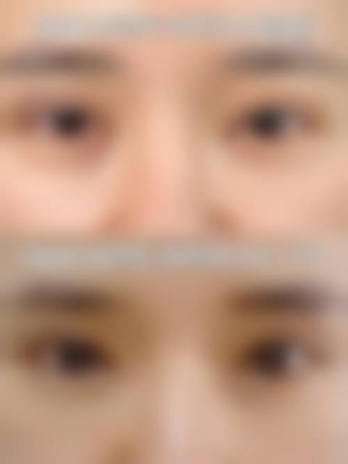 聊城市人民医院(整形外科)求美者反馈