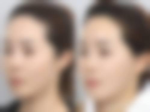 南昌张琳医疗美容门诊部特色项目及技术优势