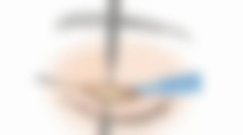 东莞莉晨医疗美容诊所来院路线