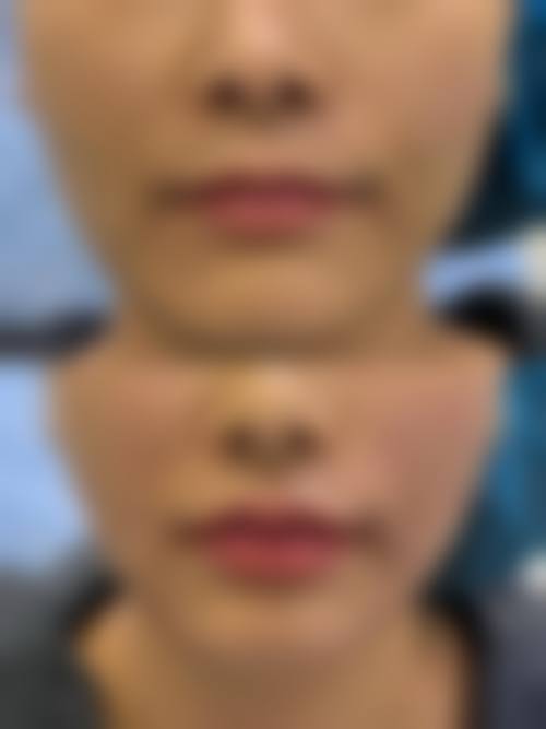 泉州赫尔本医疗美容门诊部价格收费