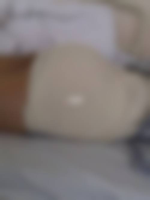 杨蓉医生的个性化定制诊疗理念