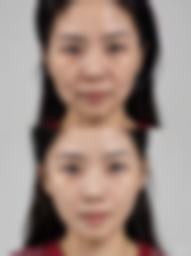 泸州葆春堂医学美容诊所价格收费
