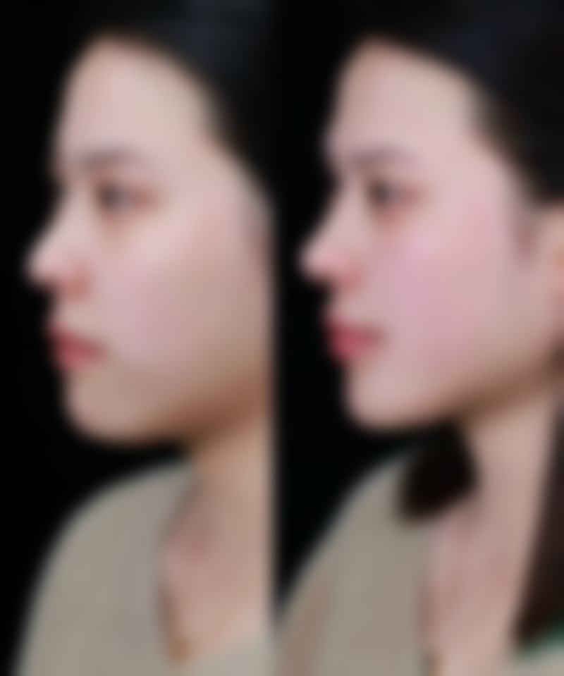 东莞中韩整形美容中 心求美者反馈