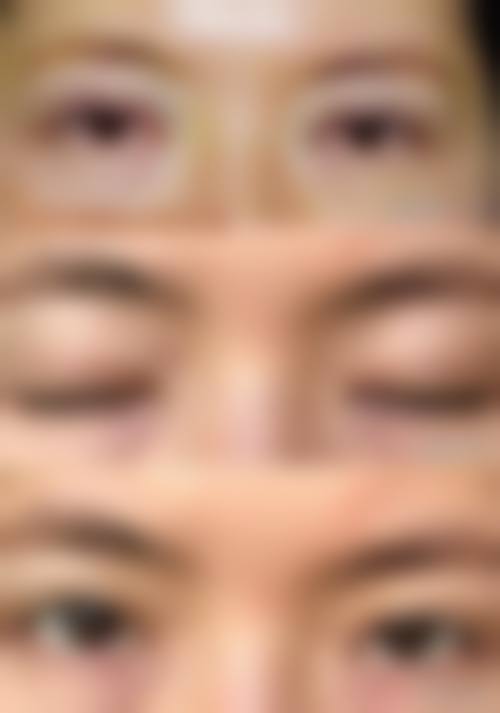 预约吴宰阭院长诊疗的方式