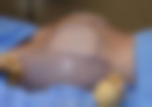 莆田庄亚强医疗美容诊所求美者反馈