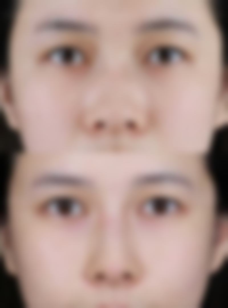 福州天宝美容整形医院求美者反馈