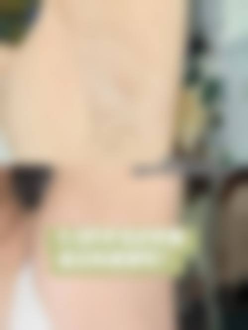 金玹秀医生的特色技术亮点