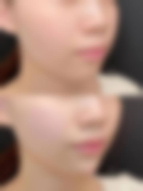 成都锦城整形美容医院价格收费