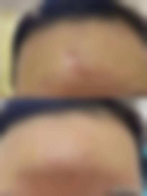 宁夏回族自治区人民医院求美者反馈
