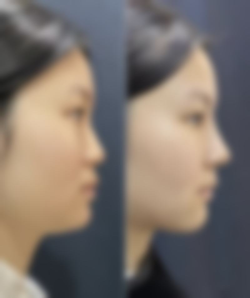 重庆美婵美媛医疗整形求美者反馈