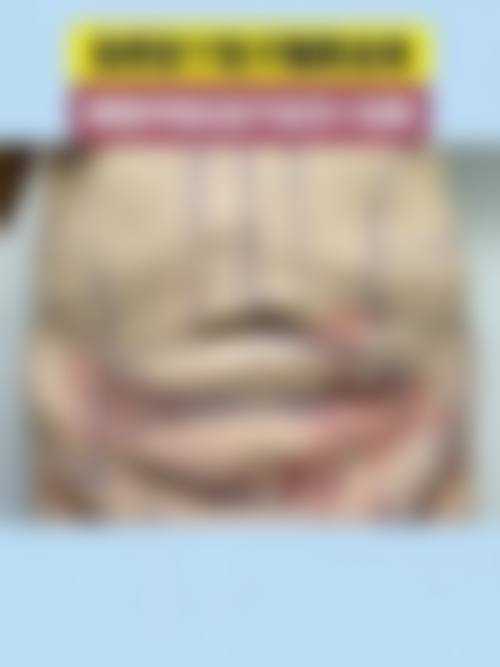 白承勋院长的个性化鼻部整形方案