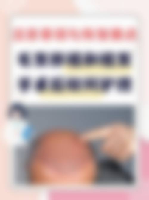 周李燕医师的特色项目价格参考