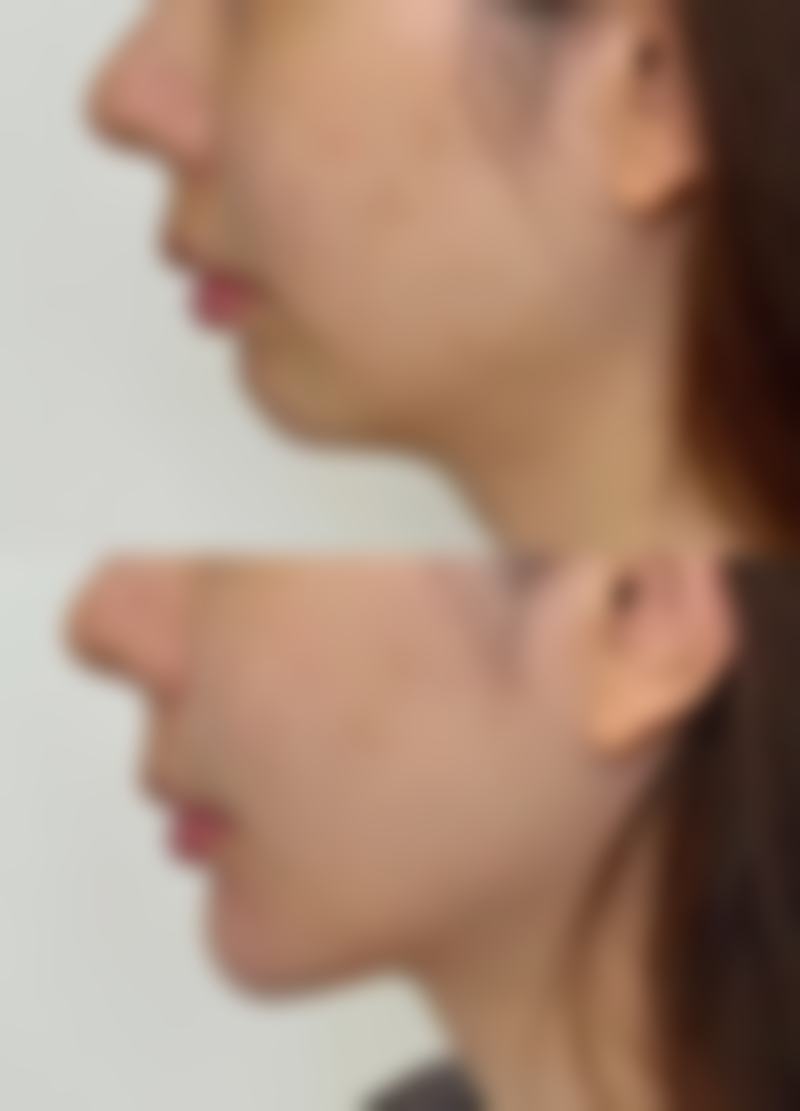 芜湖美人鱼医疗美容价格收费