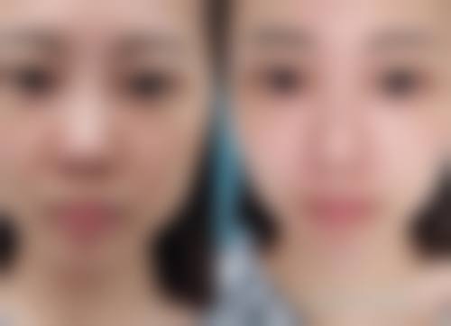 预约邓婷方医生的方式与温馨提示
