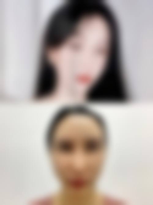 邓婷方医生擅长的特色医美项目