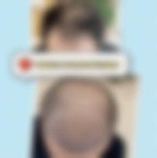 姬瑜医生采用