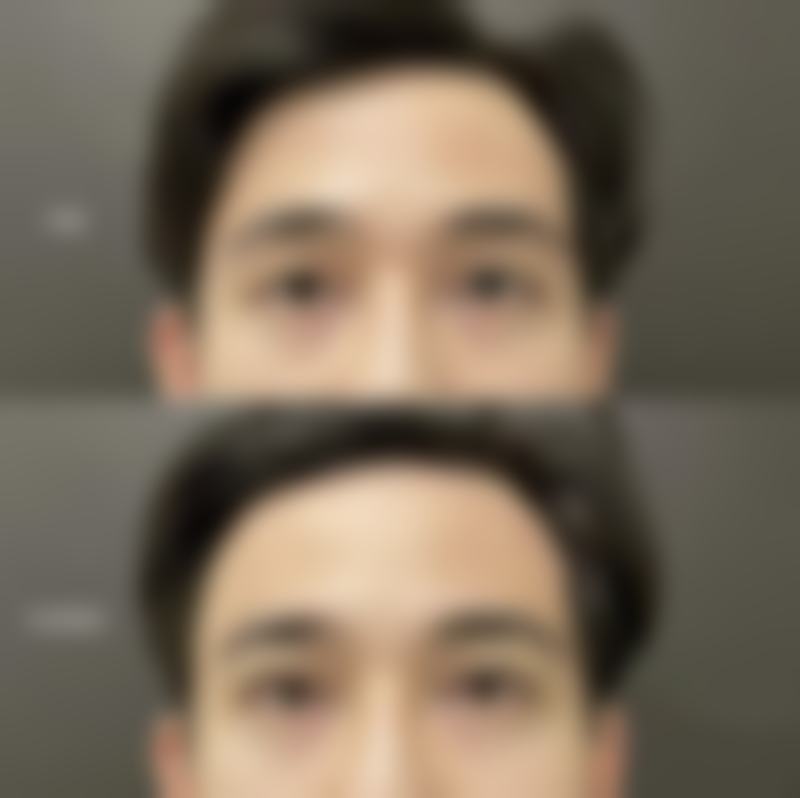 十堰亚美达医疗美容整形医院求美者反馈