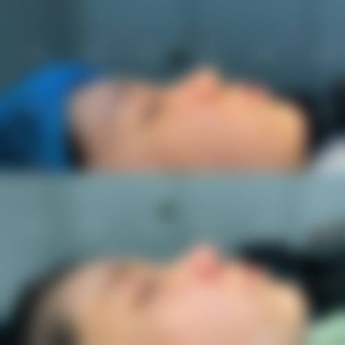 沈阳米兰辰杉整形医院求美者反馈