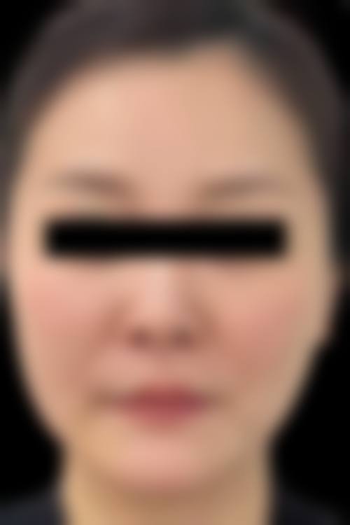 韩国本思皮肤科新沙店基本信息