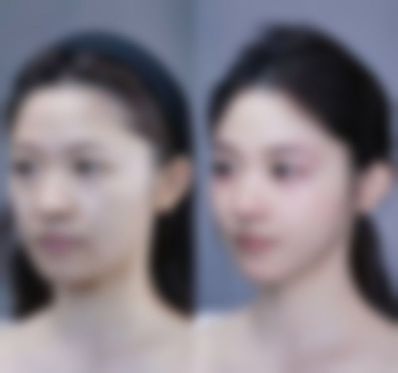 河南郑州星韵医疗美容求美者反馈
