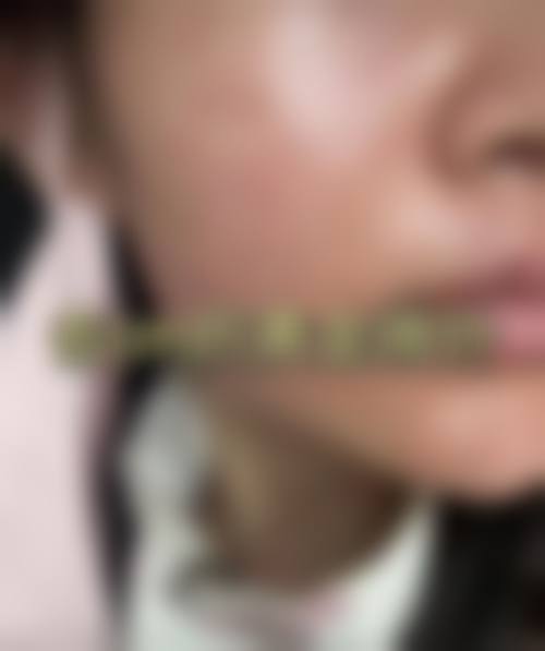 南京华韩奇致整形医院求美者反馈