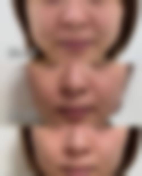 南京华韩奇致整形医院价格收费