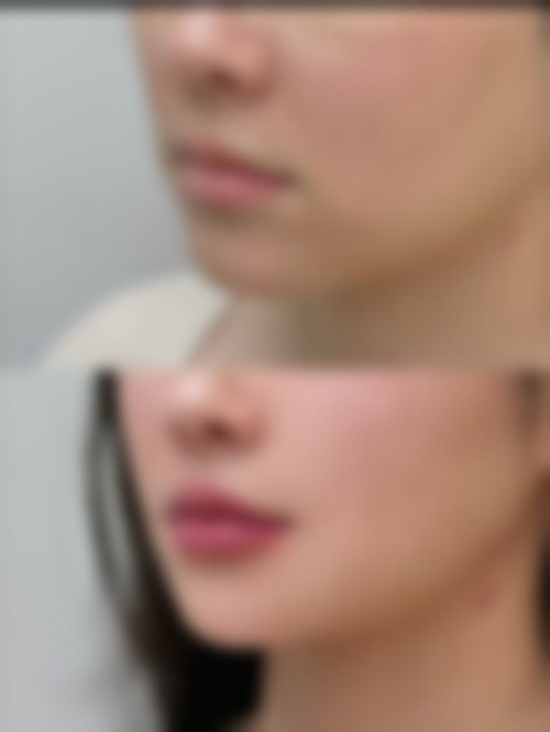 深圳橙蝶医疗美容诊所特色项目及技术优势