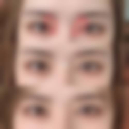 日照樱菲珂医疗美容诊所价格收费