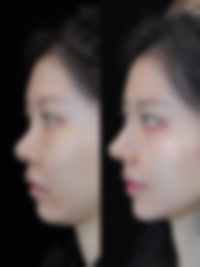 内蒙古医学校附属医院激光美容中 心特色项目及技术优势