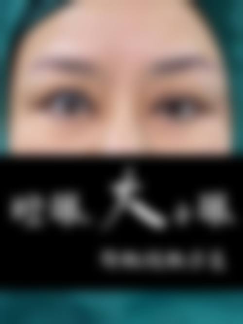 樊佳佳医生可开展的特色医美项目