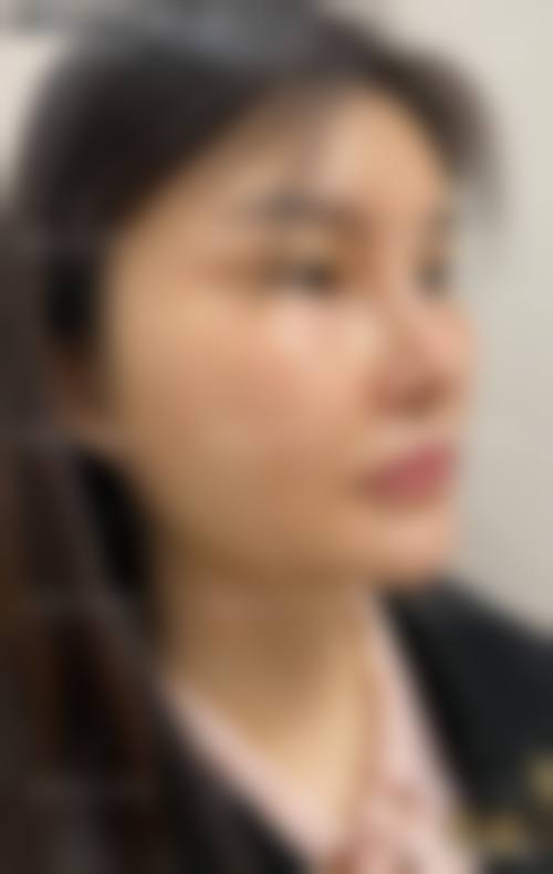 成都润美玉之光整形医院价格收费