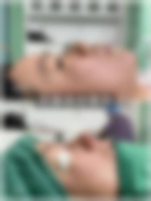 金赫秀医生的特色吸脂塑形技术