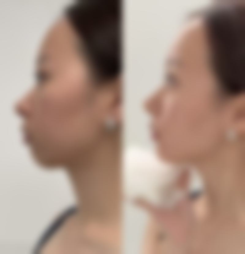 上饶卓真医疗美容门诊部求美者反馈