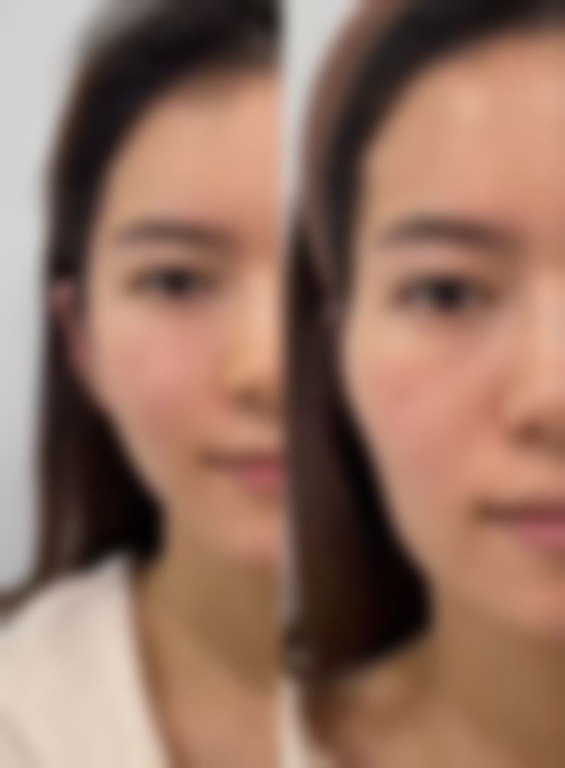 张艳锋的个性化医美服务理念