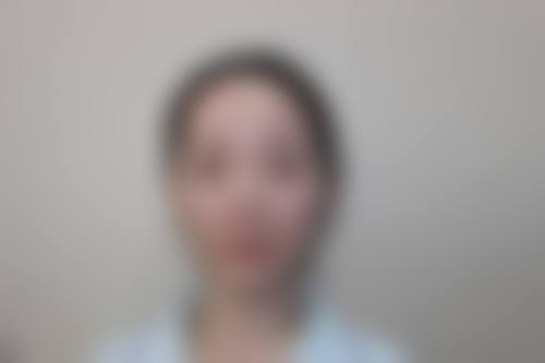 襄阳杨期耀整形医院求美者反馈