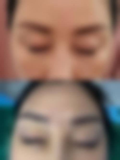 南京大麦微针植发医院求美者反馈