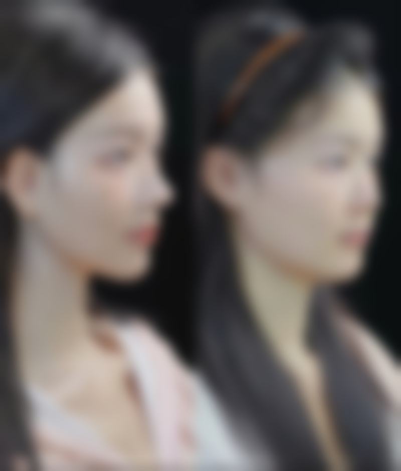 TCB横浜西口中医院求美者反馈